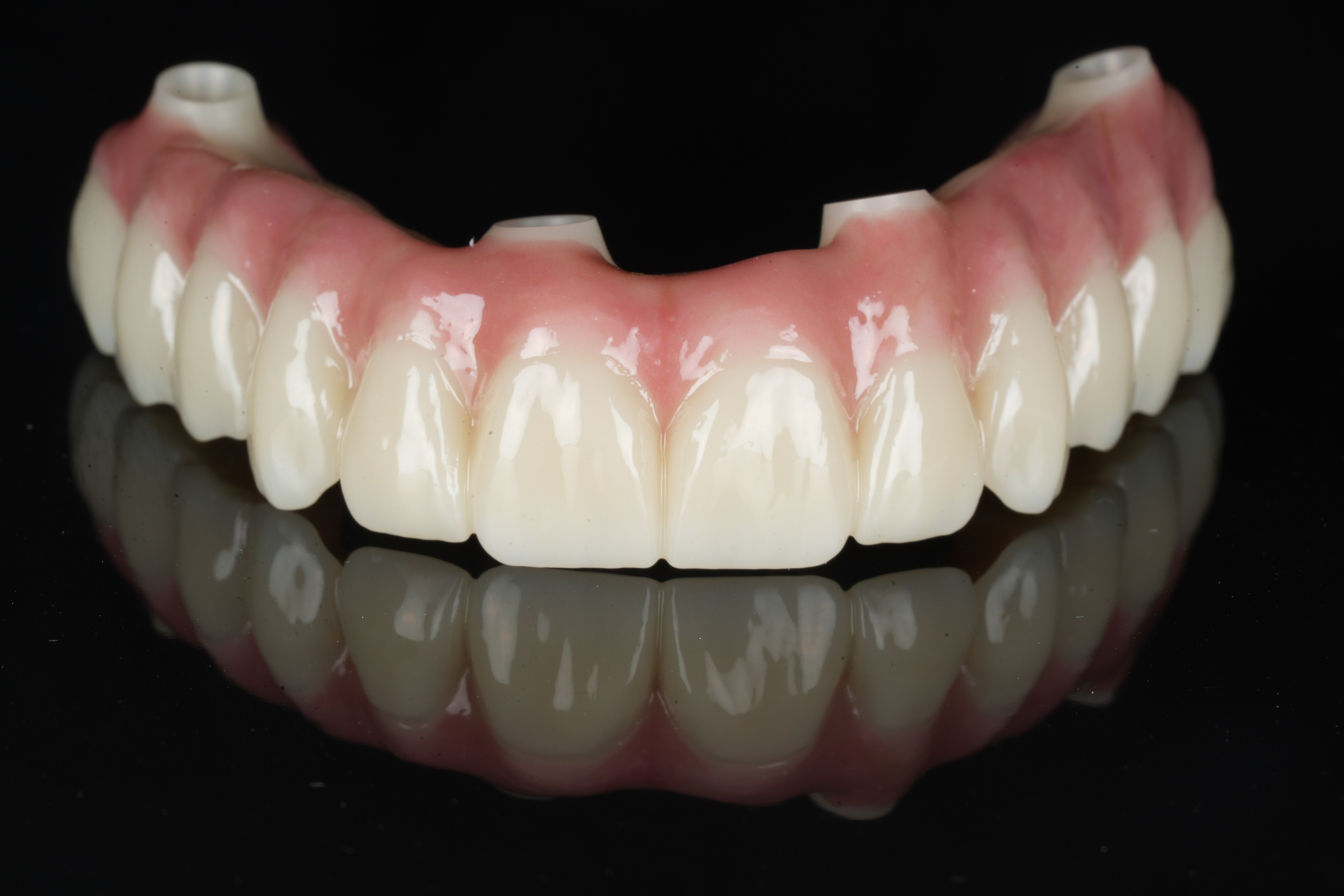 NobelProcera zirconia implant bridge in a natural shade — front view, Aria Dental Implant Center